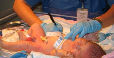 Apgar scale for newborns
